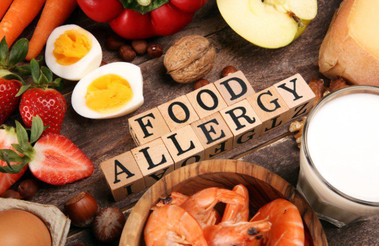 Food Allergies
