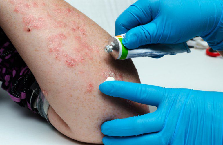 Microbiome Testing